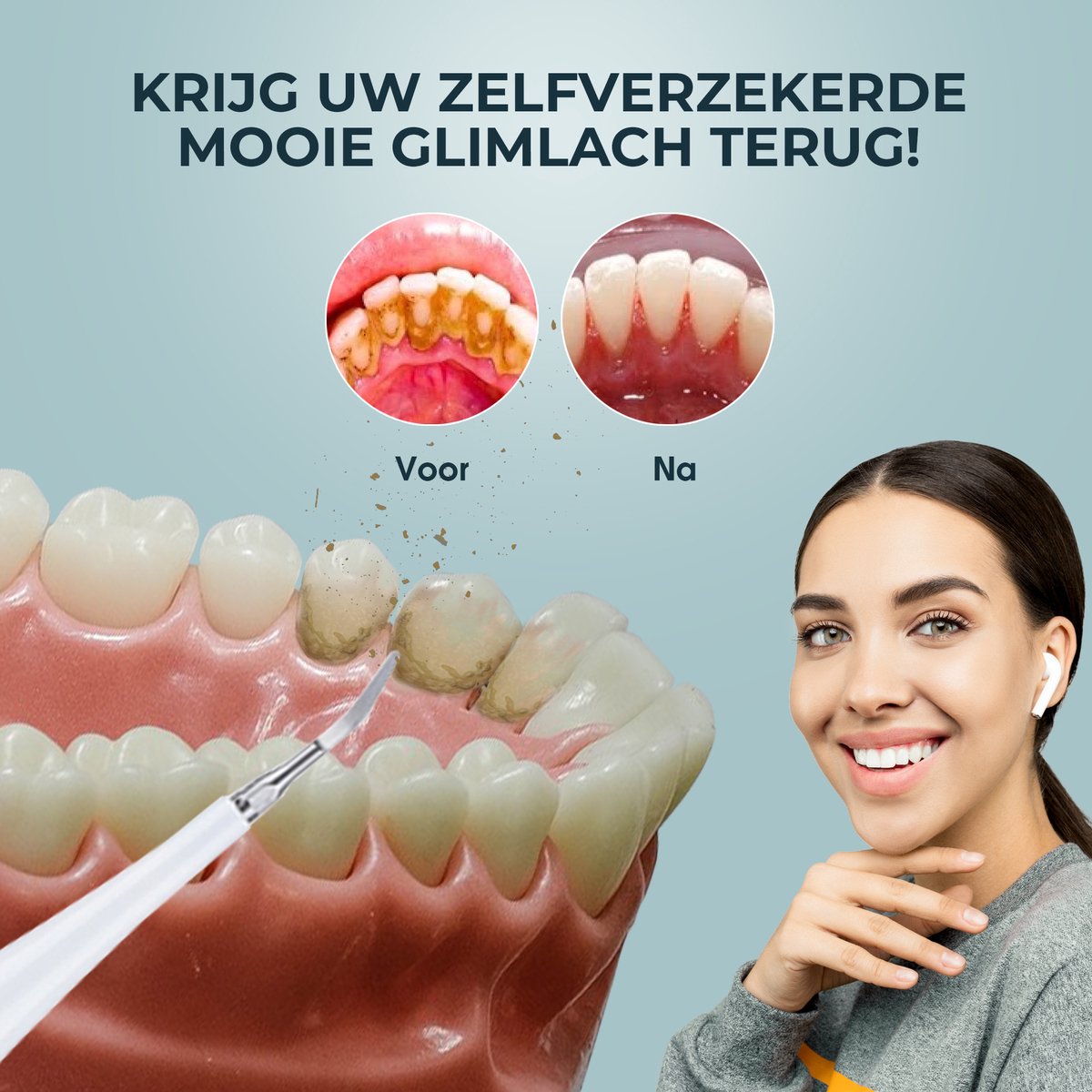 Dentect Elektrische Tandsteenverwijderaar - Wit