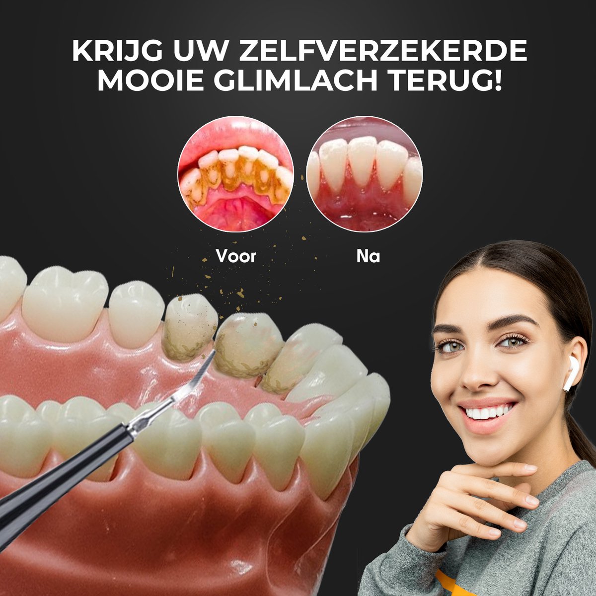 Dentect Elektrische Tandsteenverwijderaar - Zwart