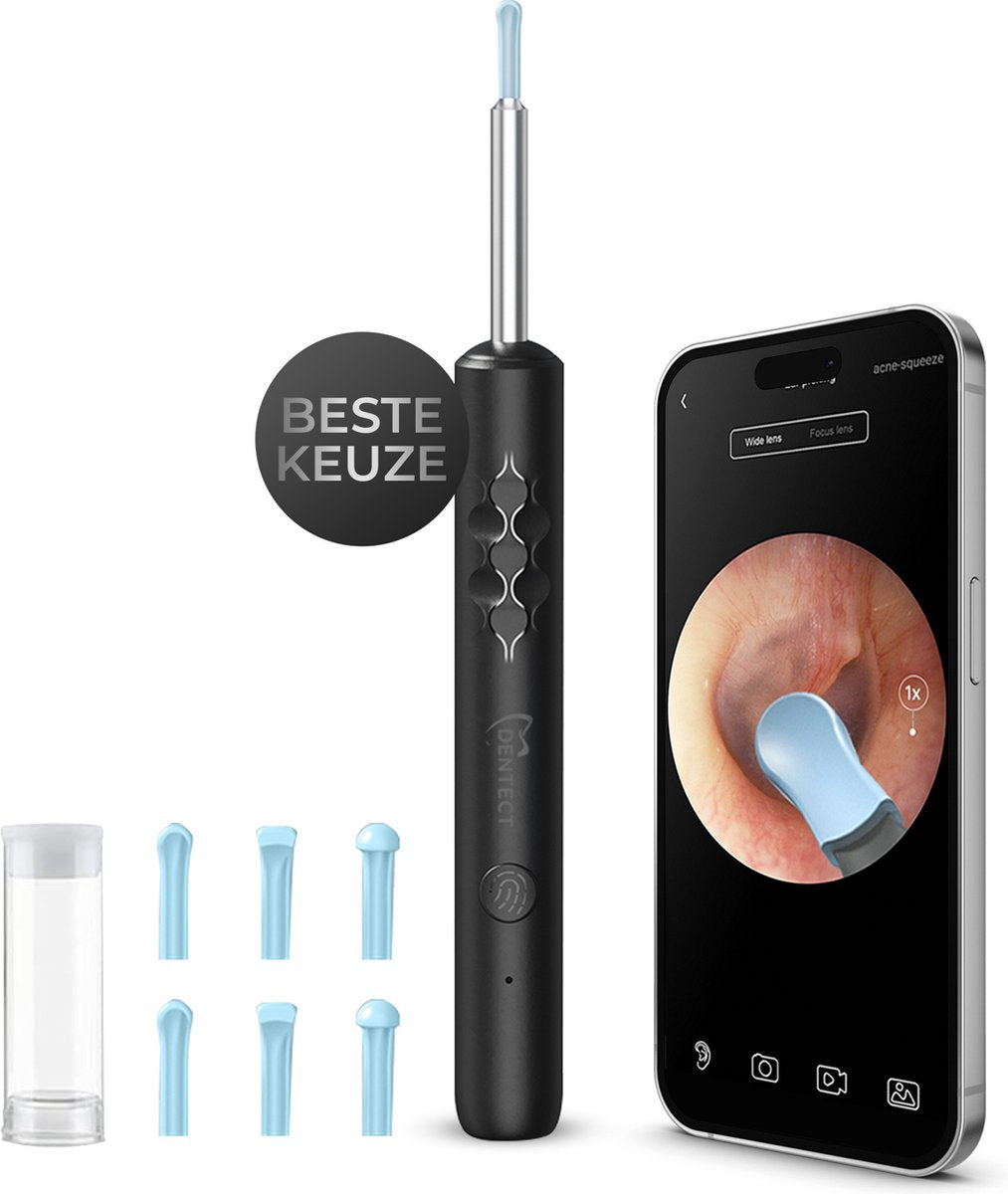 Dentect Oorsmeerverwijderaar met Camera