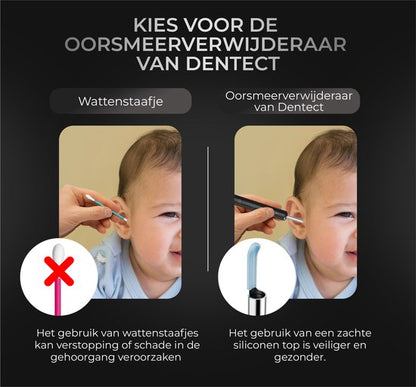 Dentect Oorsmeerverwijderaar met Camera