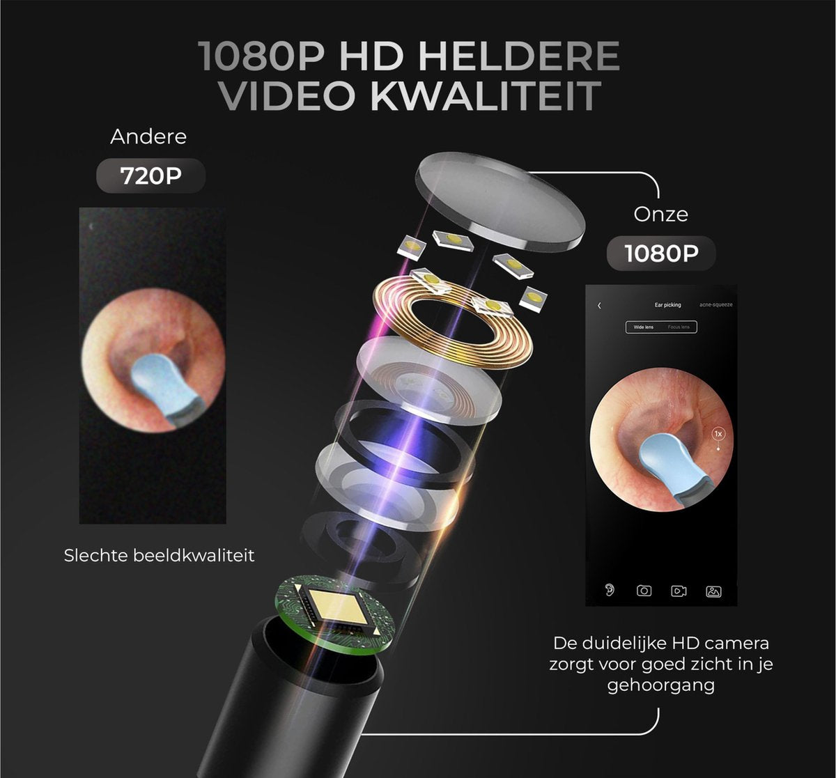 Dentect Oorsmeerverwijderaar met Camera